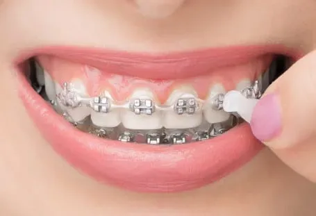Brackets