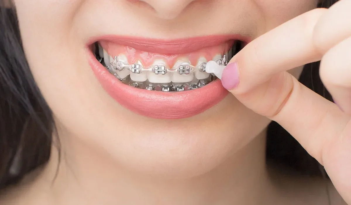 Brackets