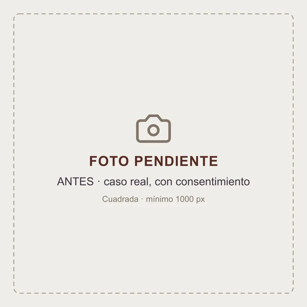 Antes