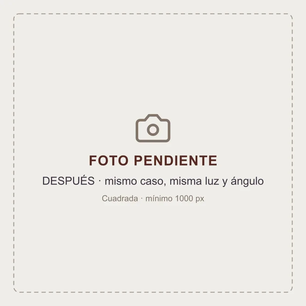 Después
